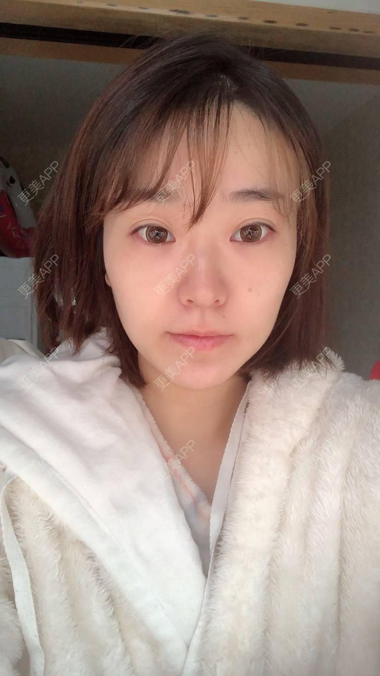 更美 - 田小雕的热玛吉经验 | 热玛吉 | 宁波