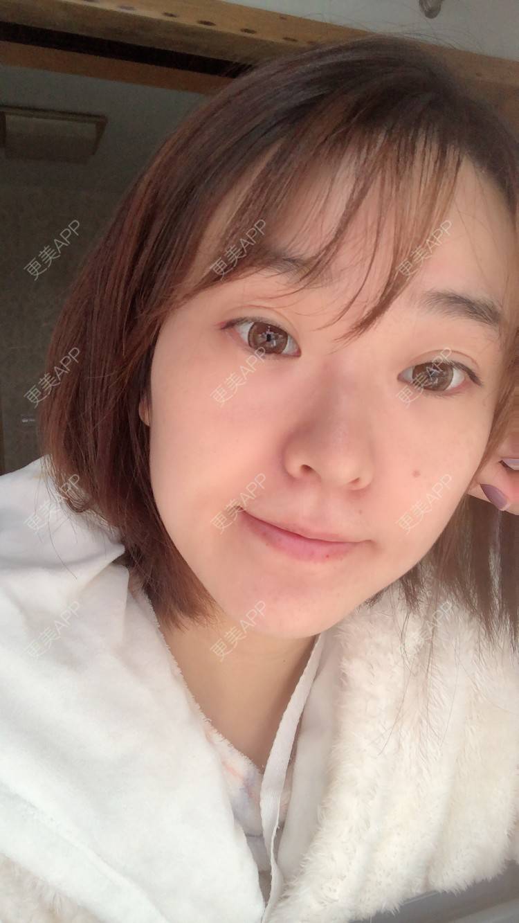 更美 - 田小雕的热玛吉经验 | 热玛吉 | 宁波