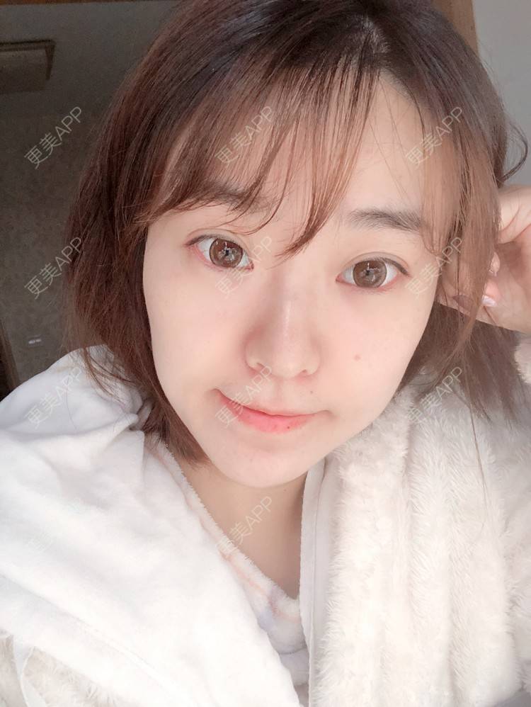 更美 - 田小雕的热玛吉经验 | 热玛吉 | 宁波