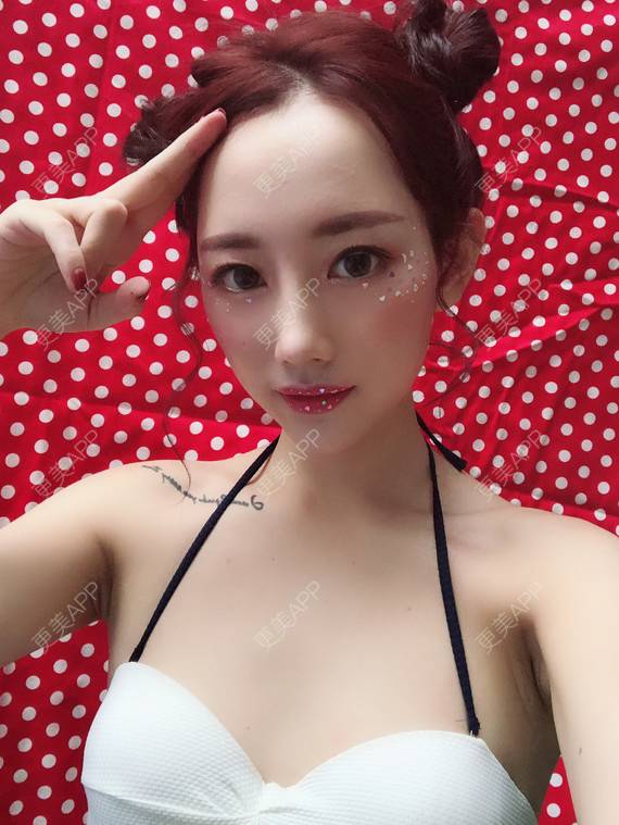 更美 - 更美用户VfI2TE1aYQ的鼻部多项经验 | 鼻部多项 | 重庆