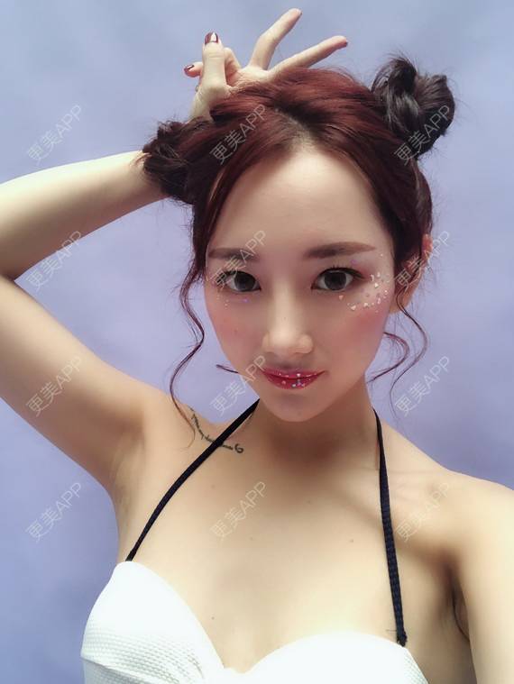 更美 - 更美用户VfI2TE1aYQ的鼻部多项经验 | 鼻部多项 | 重庆