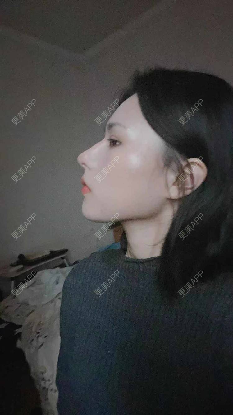 更美 - ヌ酷还可爱ˇ男的鼻部多项经验 | 鼻部多项 | 重庆