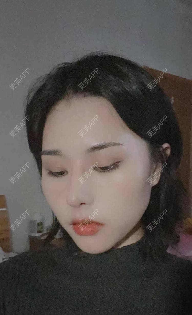 更美 - ヌ酷还可爱ˇ男的鼻部多项经验 | 鼻部多项 | 重庆