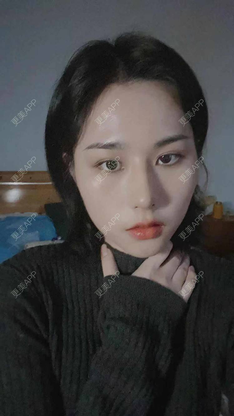 更美 - ヌ酷还可爱ˇ男的鼻部多项经验 | 鼻部多项 | 重庆