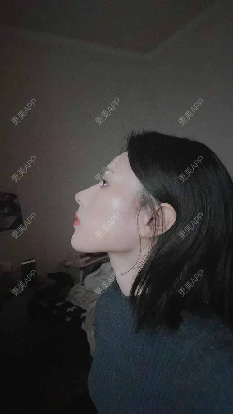更美 - ヌ酷还可爱ˇ男的鼻部多项经验 | 鼻部多项 | 重庆