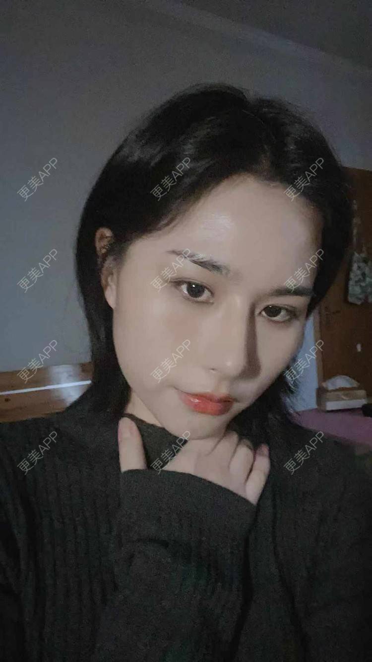 更美 - ヌ酷还可爱ˇ男的鼻部多项经验 | 鼻部多项 | 重庆