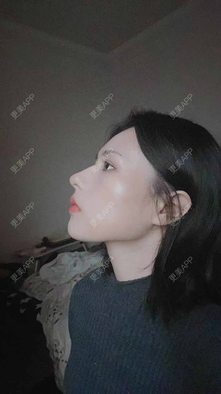 更美 - ヌ酷还可爱ˇ男的鼻部多项经验 | 鼻部多项 | 重庆