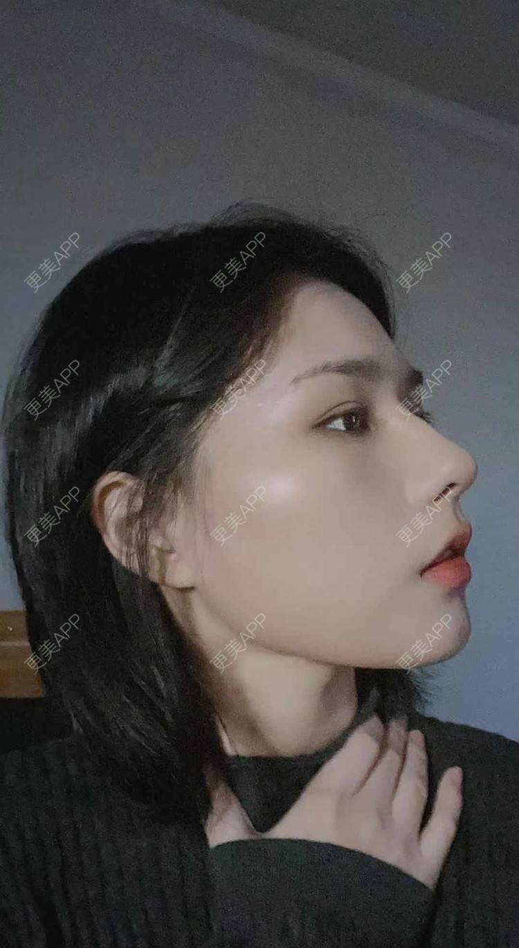 更美 - ヌ酷还可爱ˇ男的鼻部多项经验 | 鼻部多项 | 重庆