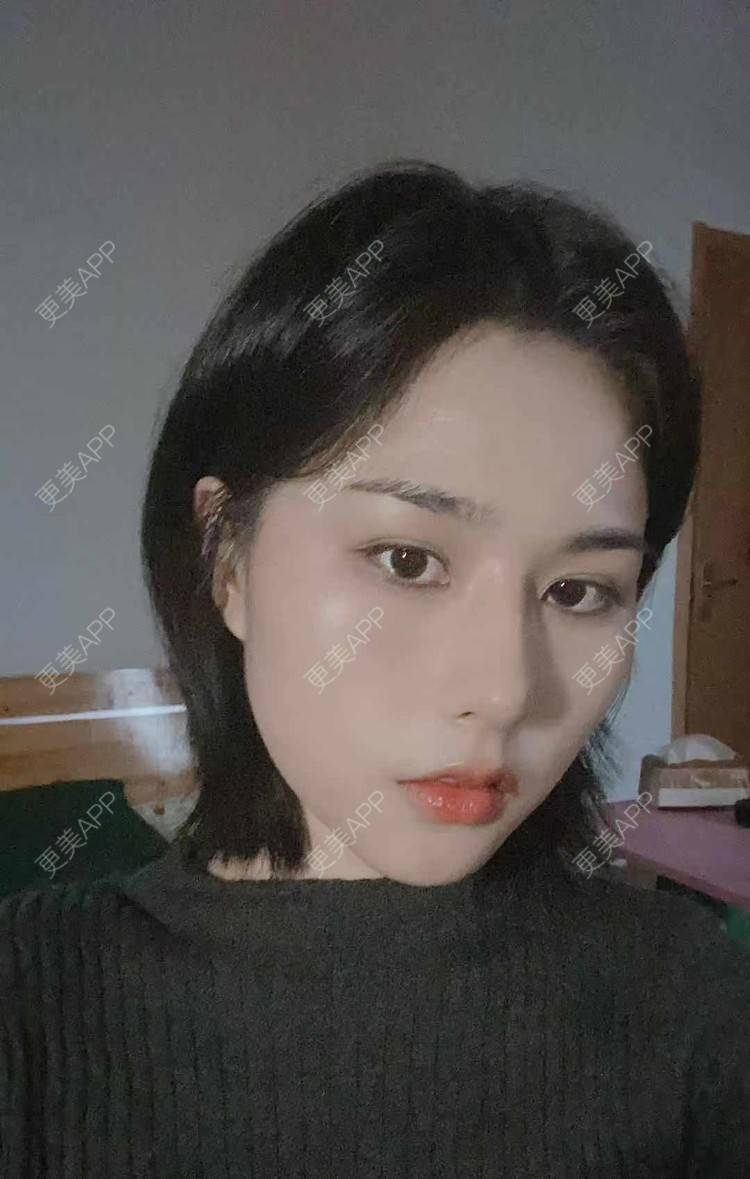 更美 - ヌ酷还可爱ˇ男的鼻部多项经验 | 鼻部多项 | 重庆