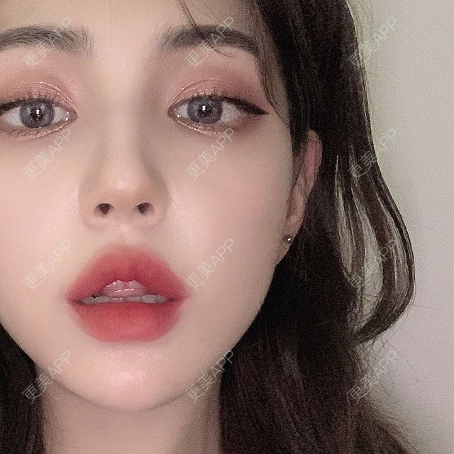 更美 - 更美用户9vbRnI9Ejv的全瓷牙经验 | 全瓷牙