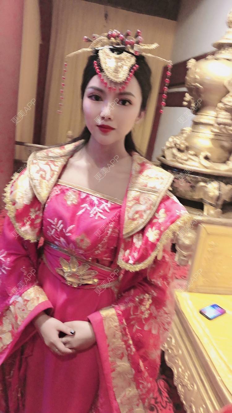 更美 - 更美用户T3PhxaY9Vo的玻尿酸下巴经验 | 广州 | 视频日记 | 玻尿酸下巴