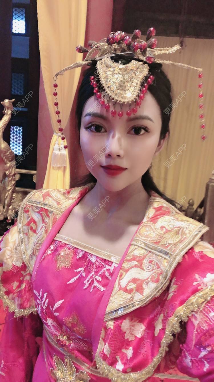 更美 - 更美用户T3PhxaY9Vo的玻尿酸下巴经验 | 广州 | 视频日记 | 玻尿酸下巴