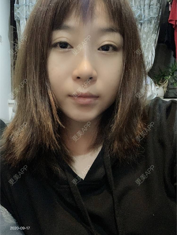 更美 - 杨会芳的半永久纹眉经验 | 上海 | 半永久纹眉 | 全飞秒激光术