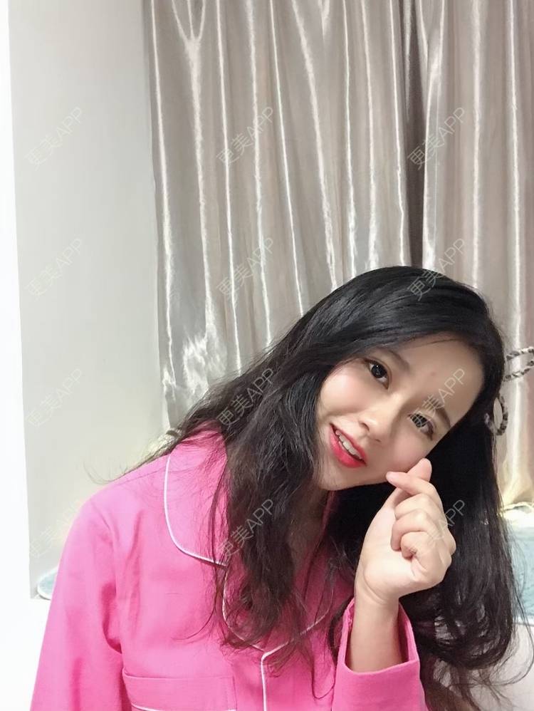 更美 - 咕噜咕噜鱼。的自体脂肪丰卧蚕经验 | 自体脂肪丰卧蚕