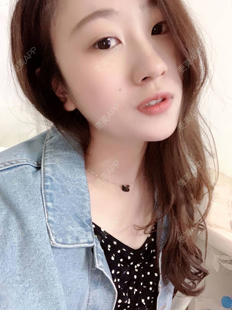 更美 - 更美用户3vmTv0rr0g的胶原蛋白注射经验 | 胶原蛋白注射 | 沈阳 | 视频日记