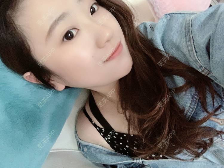 更美 - 更美用户3vmTv0rr0g的胶原蛋白注射经验 | 胶原蛋白注射 | 沈阳 | 视频日记