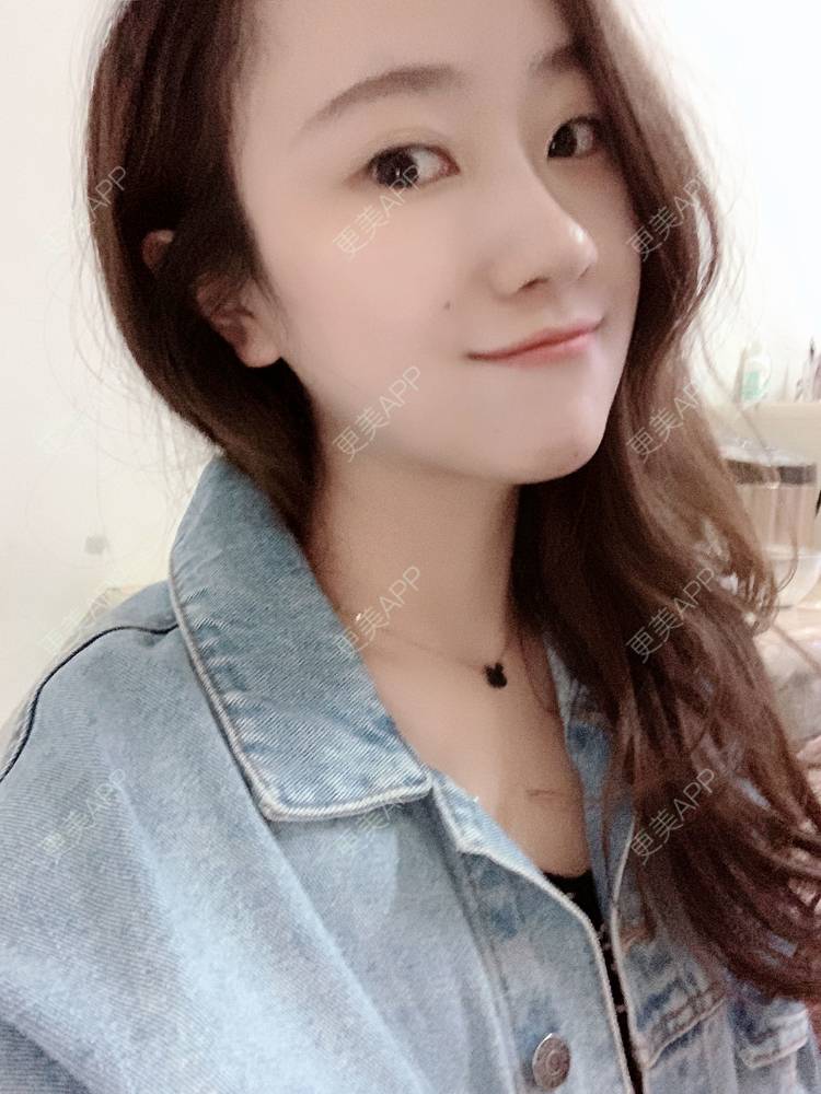 更美 - 更美用户3vmTv0rr0g的胶原蛋白注射经验 | 胶原蛋白注射 | 沈阳 | 视频日记