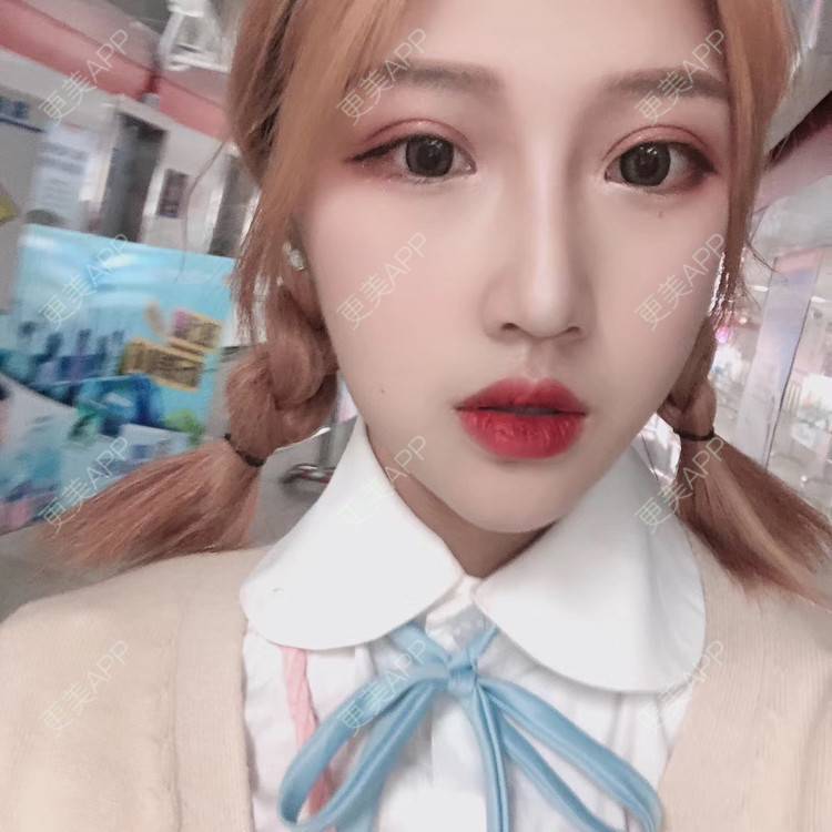 更美 - 萤萤如画的颧骨内推经验 | 广州 | 颧骨内推 | 视频日记