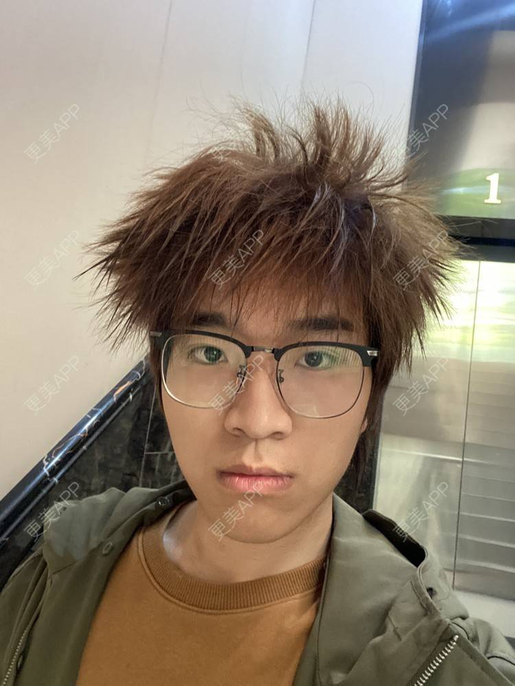 更美 - ＹＩＹＩ的眼部多项经验 | 长沙 | 眼部多项