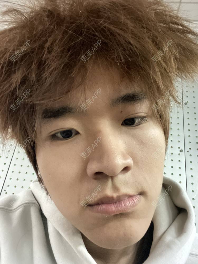 更美 - ＹＩＹＩ的眼部多项经验 | 长沙 | 眼部多项