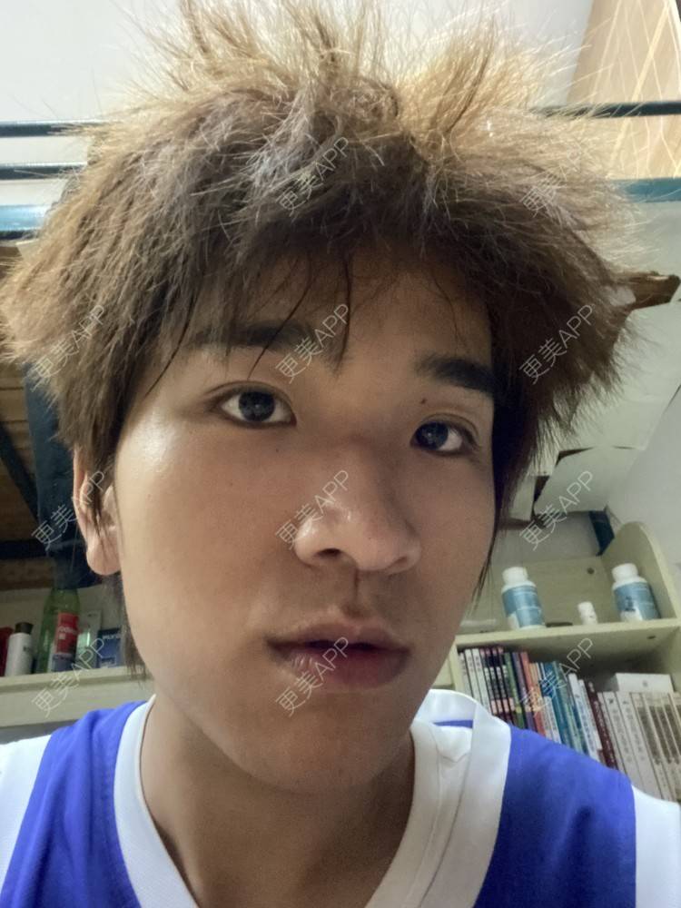 更美 - ＹＩＹＩ的眼部多项经验 | 视频日记 | 长沙 | 眼部多项