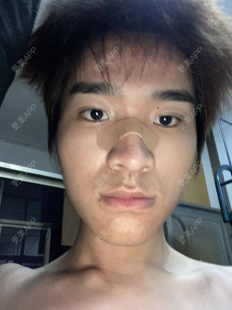 更美 - ＹＩＹＩ的眼部多项经验 | 视频日记 | 长沙 | 眼部多项