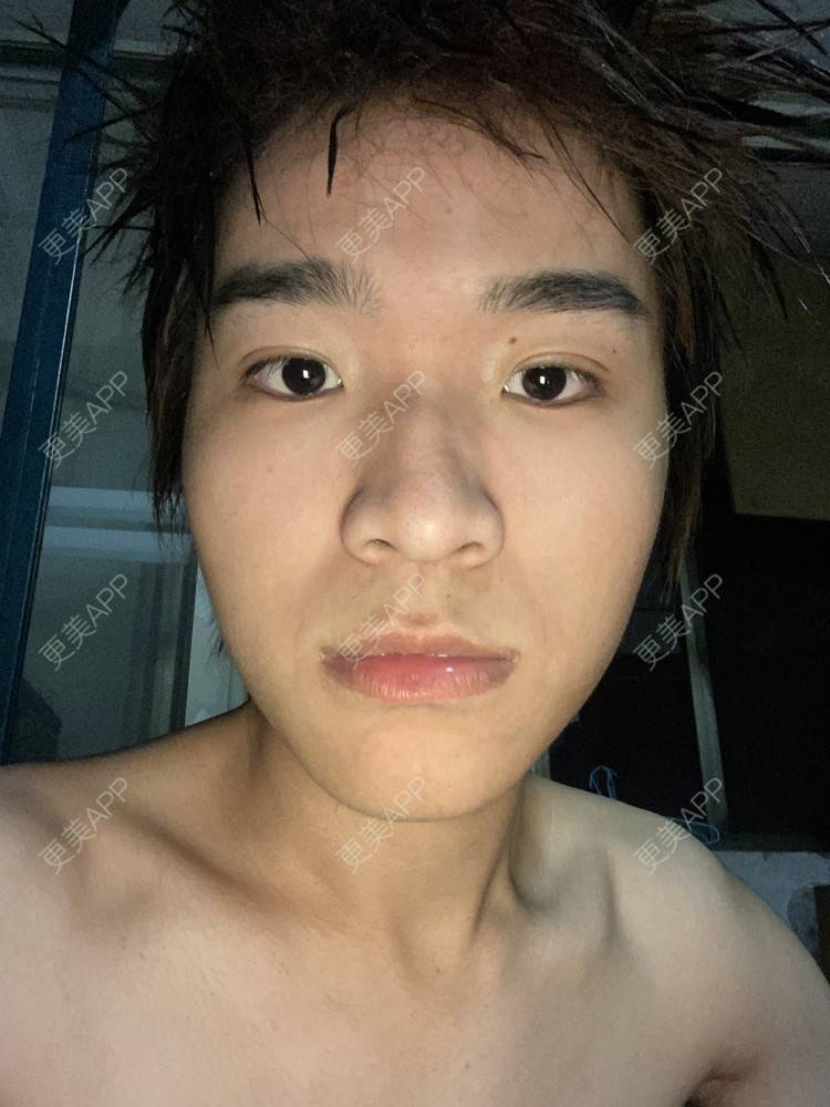 更美 - ＹＩＹＩ的眼部多项经验 | 视频日记 | 长沙 | 眼部多项