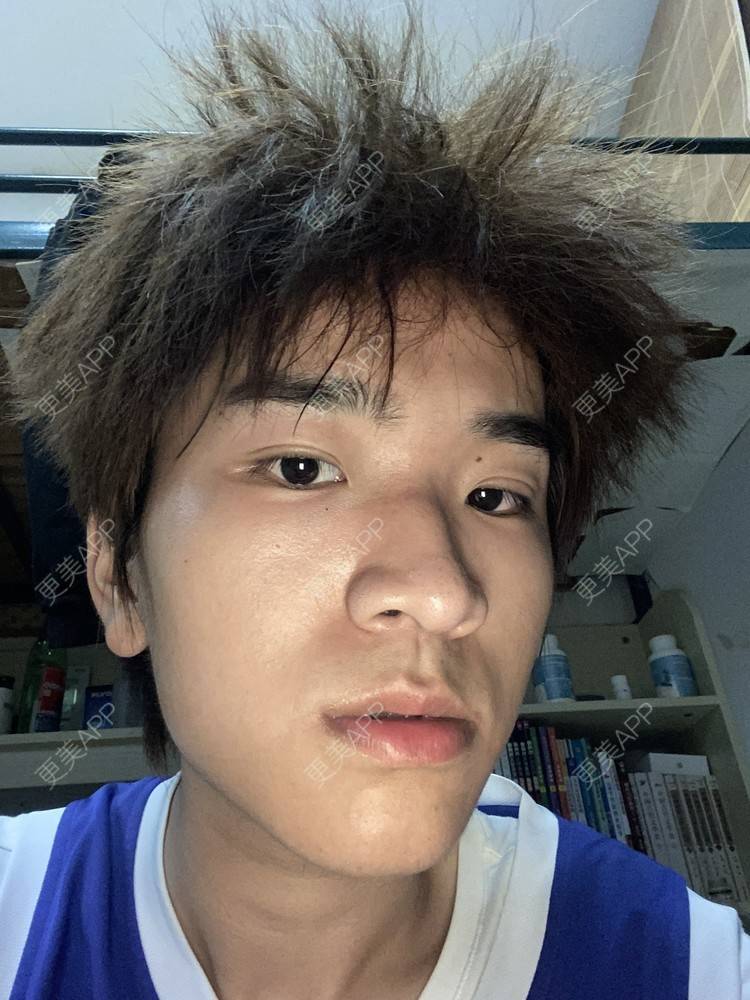 更美 - ＹＩＹＩ的眼部多项经验 | 视频日记 | 长沙 | 眼部多项