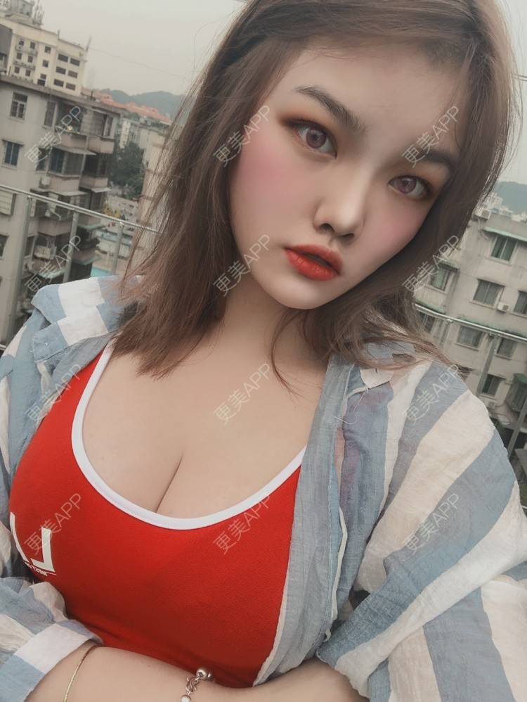 更美 - 更美用户pO1qWVHYOc的假体隆胸经验 | 广州 | 视频日记 | 假体隆胸