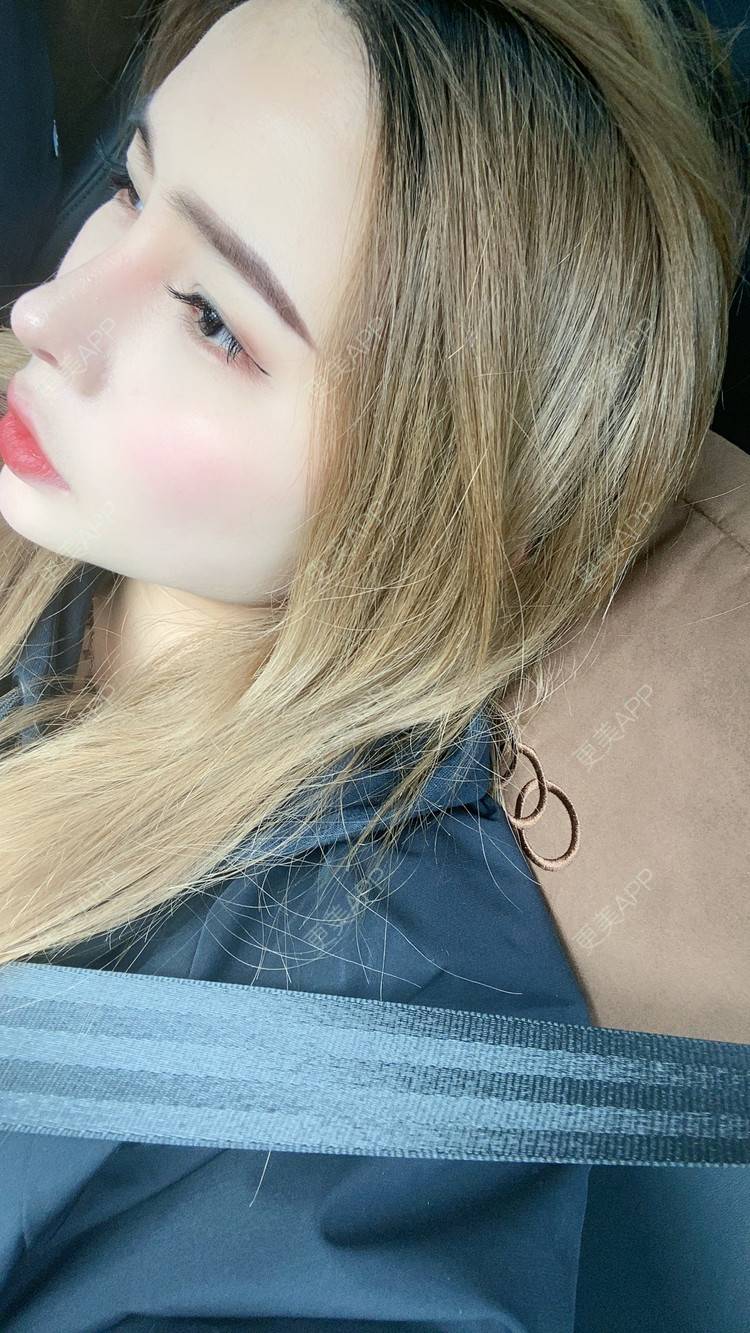 更美 - 大CC阿姨的肋软骨隆鼻经验 | 成都 | 肋软骨隆鼻 | 视频日记