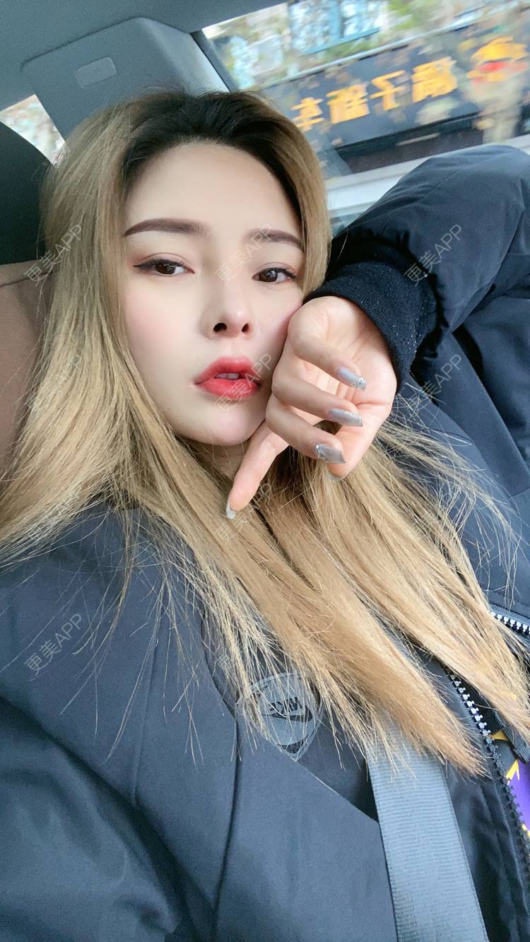 更美 - 大CC阿姨的肋软骨隆鼻经验 | 成都 | 肋软骨隆鼻 | 视频日记