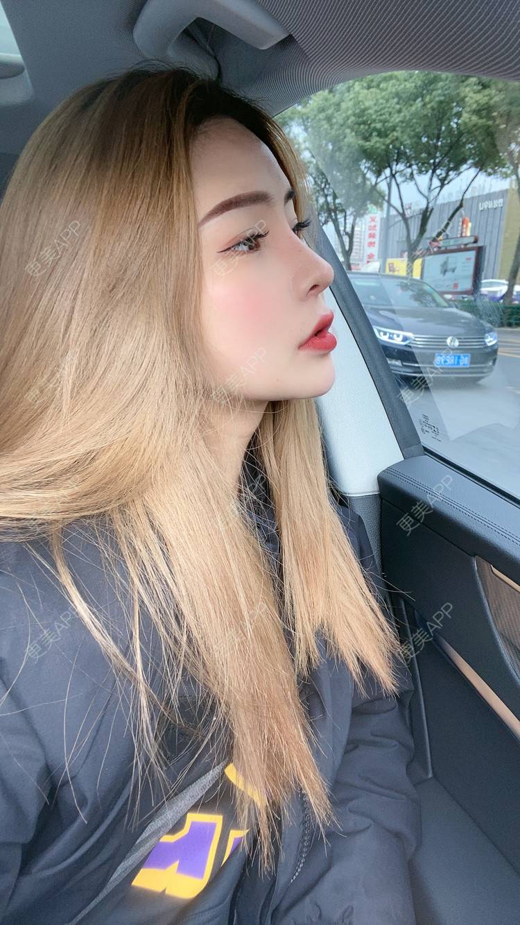 更美 - 大CC阿姨的肋软骨隆鼻经验 | 成都 | 肋软骨隆鼻 | 视频日记