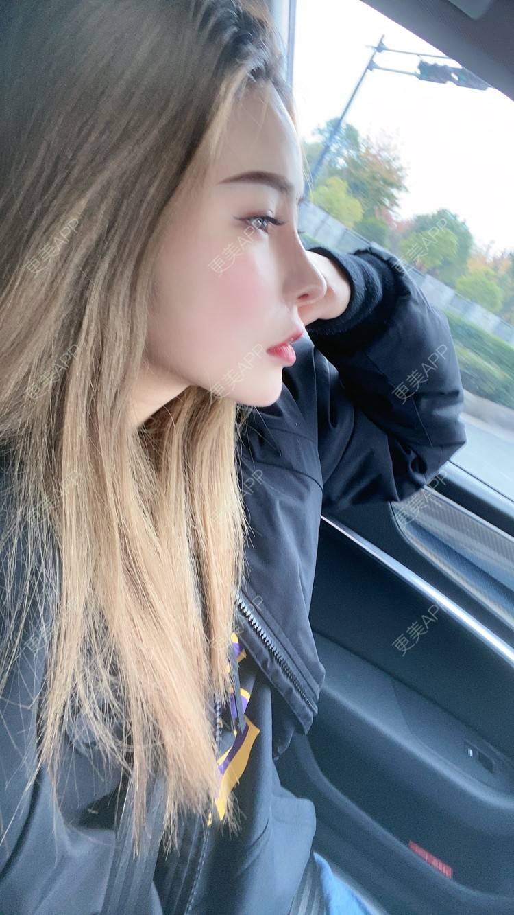 更美 - 大CC阿姨的肋软骨隆鼻经验 | 成都 | 肋软骨隆鼻 | 视频日记