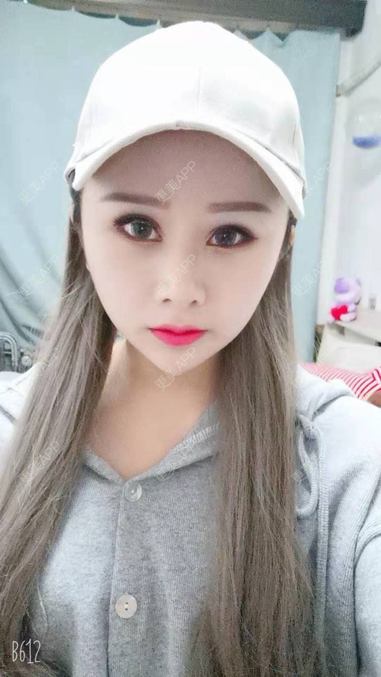 更美 - 猥琐女放的下颌角切除经验 | 上海 | 颧骨内推 | 下颌角切除