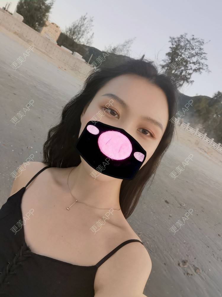 更美 - 更美用户1fHxMDJVIE的眼部多项经验 | 眼部多项 | 广州