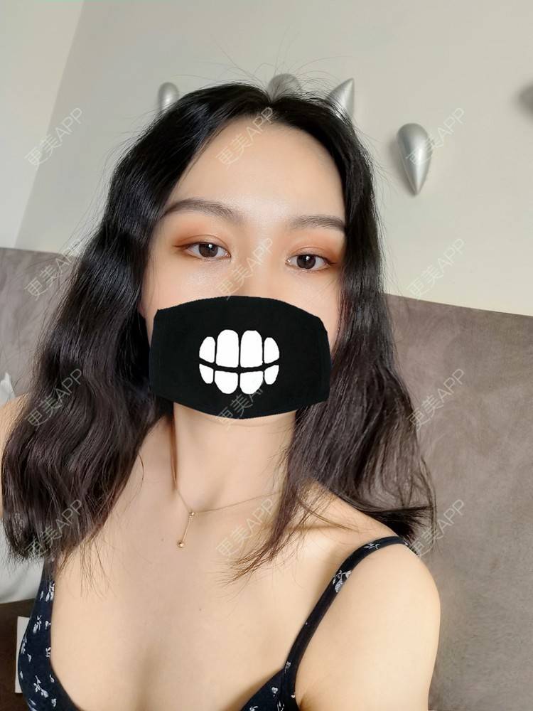 更美 - 更美用户1fHxMDJVIE的眼部多项经验 | 眼部多项 | 广州