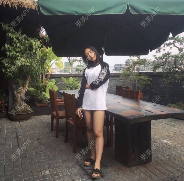 更美 - Rule宅男燃的吸脂经验 | 武汉 | 吸脂