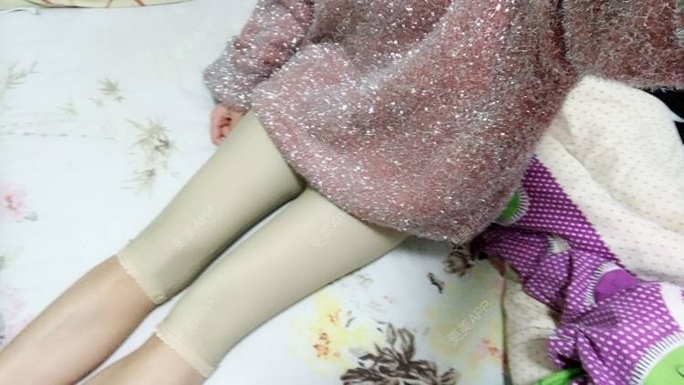 更美 - 心奴@潜的吸脂经验 | 武汉 | 吸脂