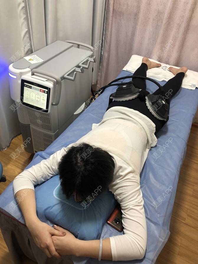 更美 - 更美用户NZ9xukLRlL的射频溶脂瘦腹部经验 | 深圳 | 射频溶脂瘦腹部