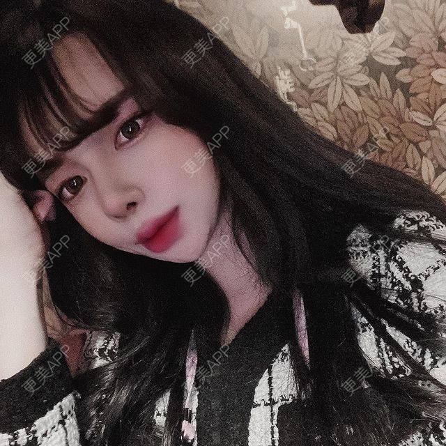 更美 - 更美用户Gl7T42uJrZ的唇综合经验 | 上海 | 唇综合