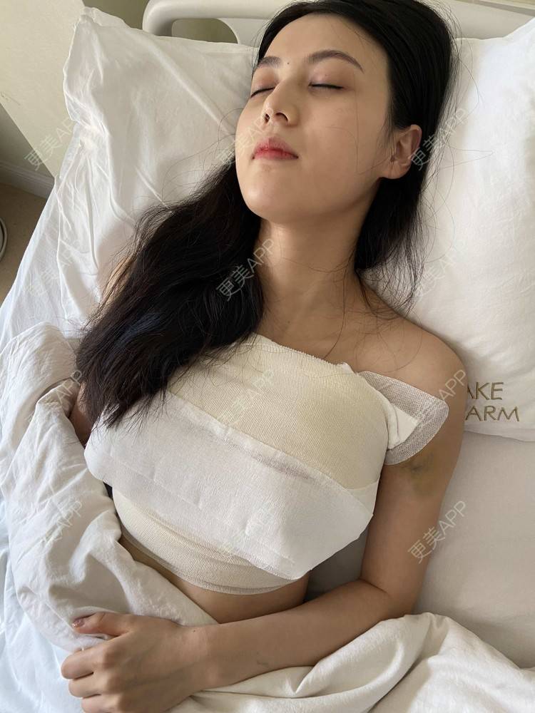 小宇宙卡卡的丰胸隆胸日记