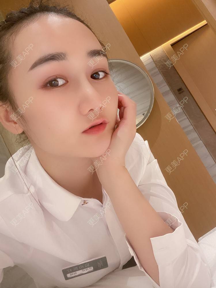 更美 - Yancy🧚‍♀️的隆鼻经验 | 隆鼻 | 鼻部多项 | 膨体隆鼻 | 肋软骨隆鼻 | 鼻翼缩小 | 深圳 | 长鼻矫正 | 视频日记