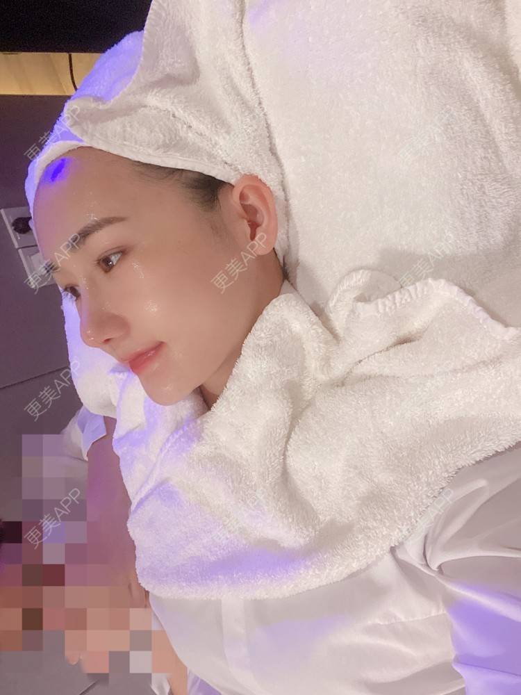 更美 - Yancy🧚‍♀️的隆鼻经验 | 隆鼻 | 鼻部多项 | 膨体隆鼻 | 肋软骨隆鼻 | 鼻翼缩小 | 深圳 | 长鼻矫正 | 视频日记