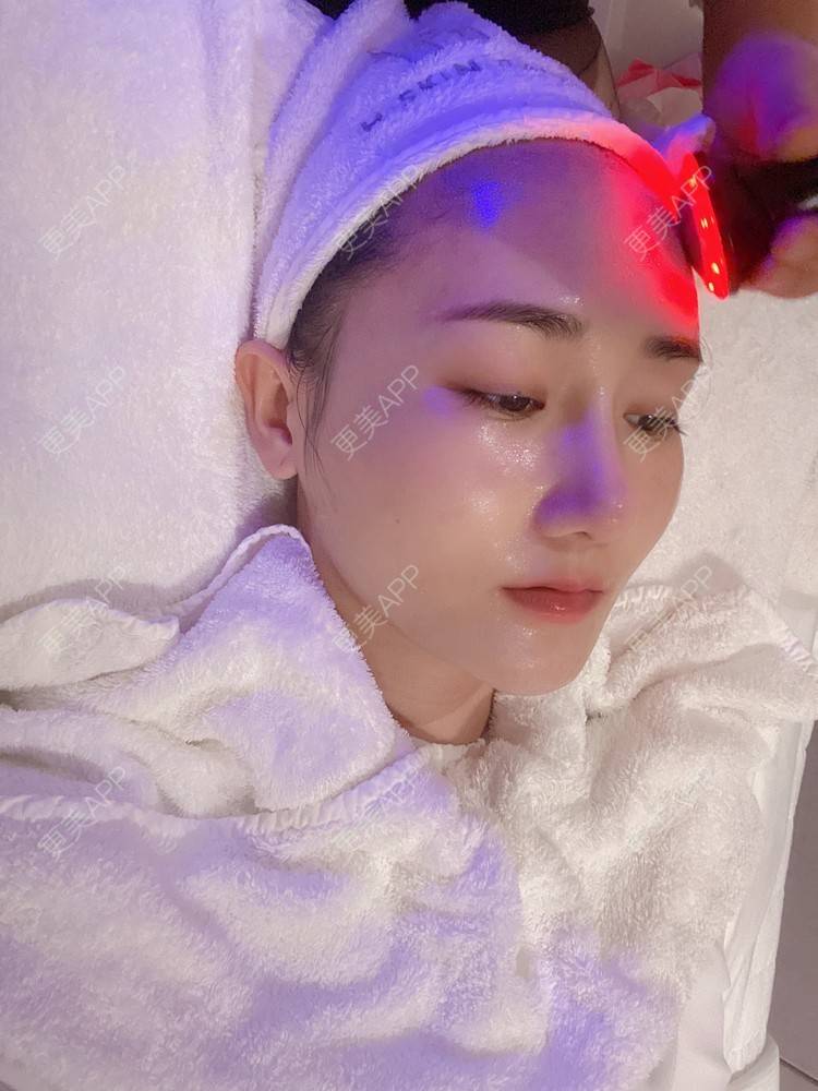 更美 - Yancy🧚‍♀️的隆鼻经验 | 隆鼻 | 鼻部多项 | 膨体隆鼻 | 肋软骨隆鼻 | 鼻翼缩小 | 深圳 | 长鼻矫正 | 视频日记