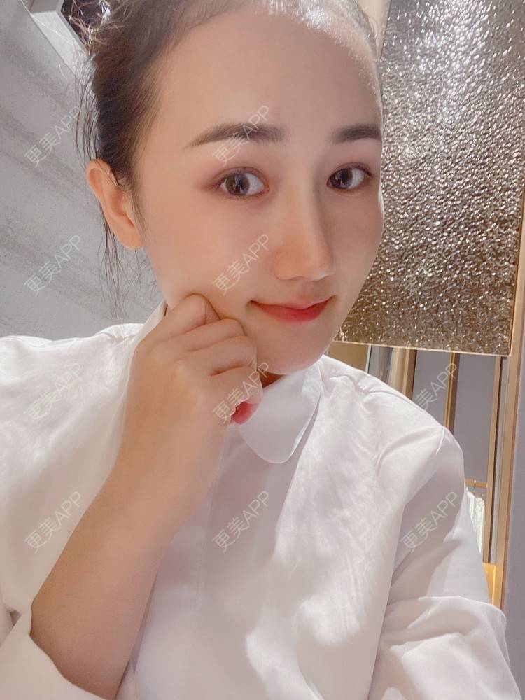 更美 - Yancy🧚‍♀️的隆鼻经验 | 隆鼻 | 鼻部多项 | 膨体隆鼻 | 肋软骨隆鼻 | 鼻翼缩小 | 深圳 | 长鼻矫正 | 视频日记