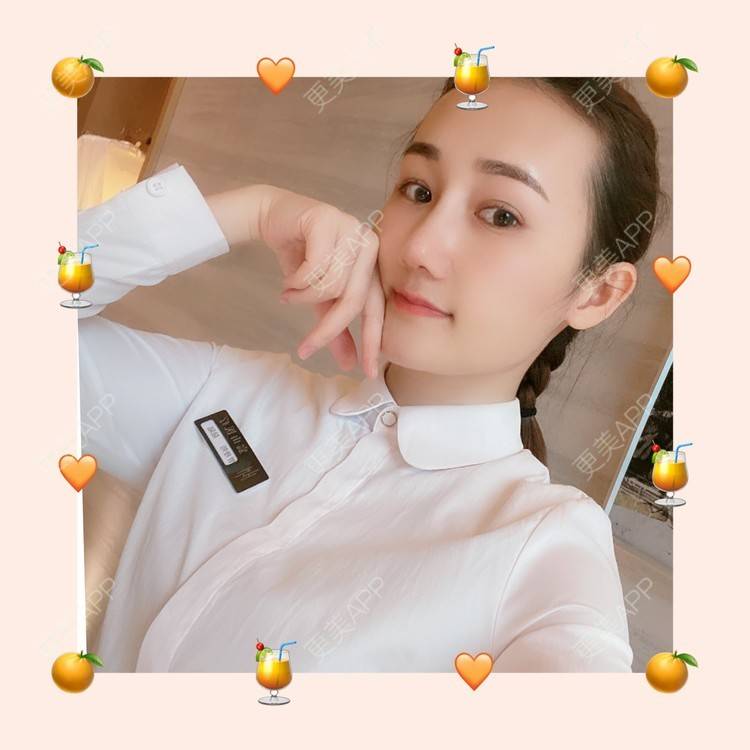 更美 - Yancy🧚‍♀️的隆鼻经验 | 隆鼻 | 鼻部多项 | 膨体隆鼻 | 肋软骨隆鼻 | 鼻翼缩小 | 深圳 | 长鼻矫正 | 视频日记