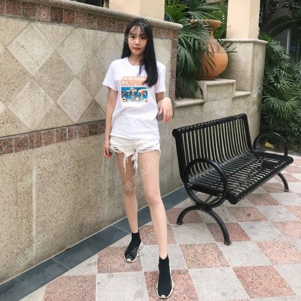 更美 - 岸芷1的吸脂经验 | 武汉 | 吸脂