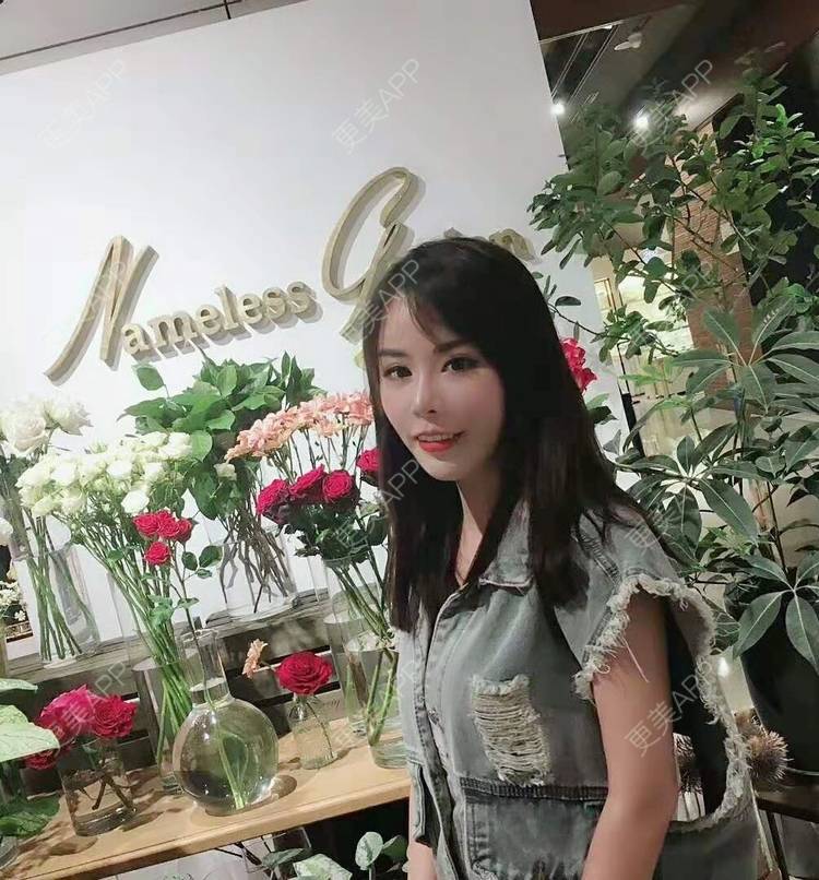 更美 - 猫耳朵的生活的自体脂肪填充法令纹经验 | 自体脂肪填充法令纹 | 自体脂肪隆胸 | 深圳 | 超声溶脂瘦手臂 | 超声溶脂瘦腹部 | 超声溶脂瘦背部
