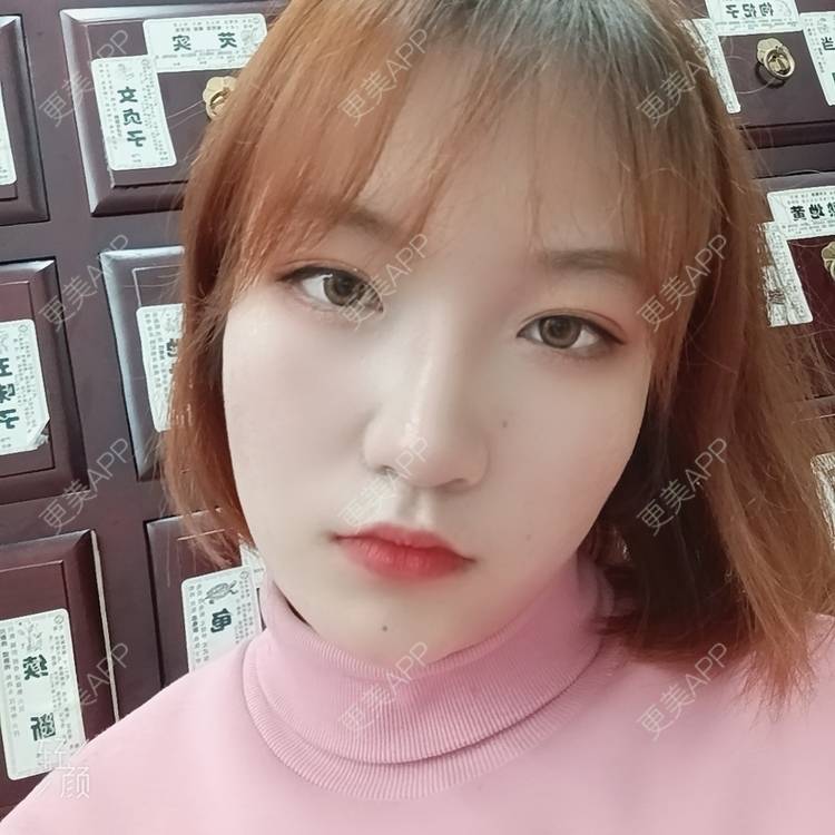 更美 - 更美用户tbs28rKiLZ的定点双眼皮经验 | 定点双眼皮 | 杭州