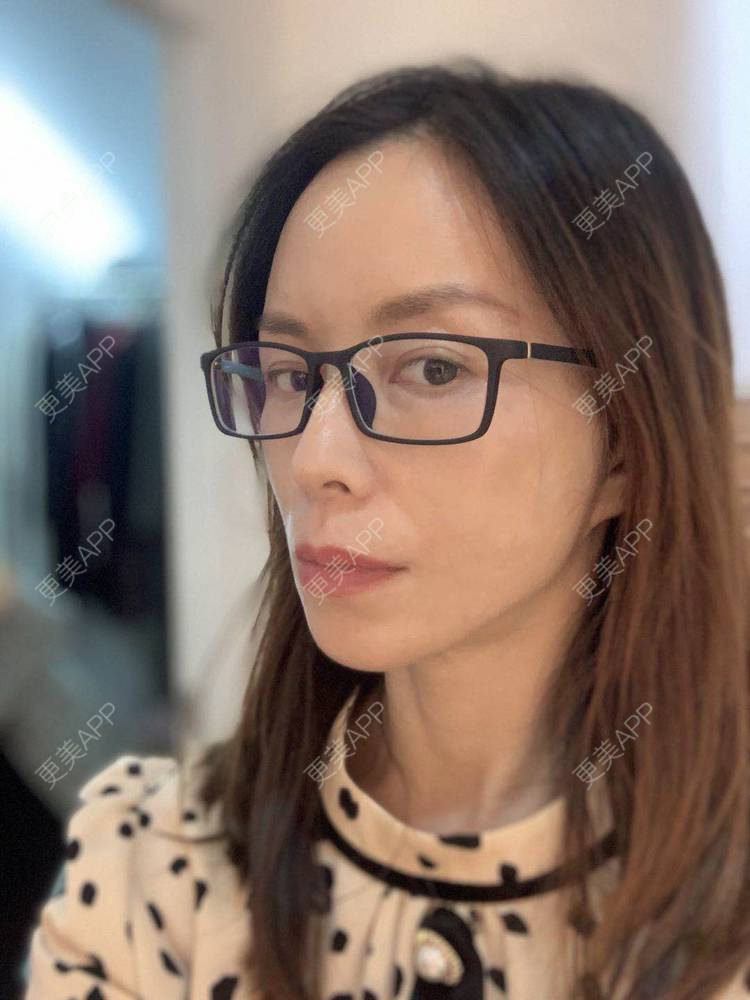 更美 - 更美用户m5TLM1rzA5的拉皮经验 | 拉皮 | 北京